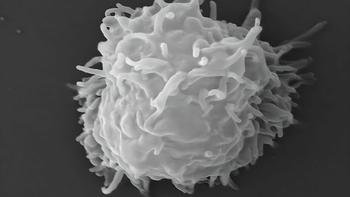 Man Dies from Amoeba Infection